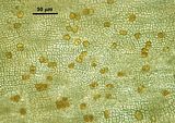 Visione superficiale degli organi pluriloculari con ascocisti